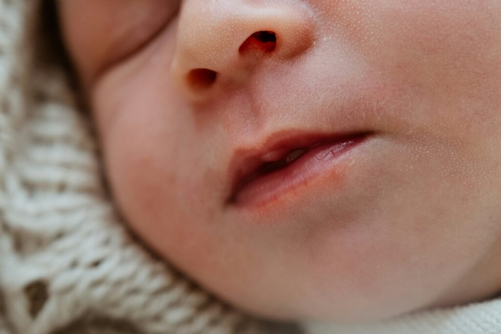 milk blisters on newborn lips