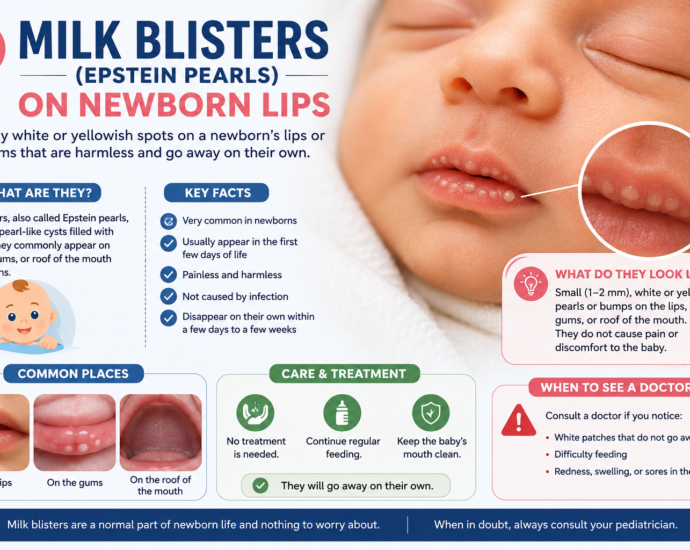 milk blisters on newborn lips